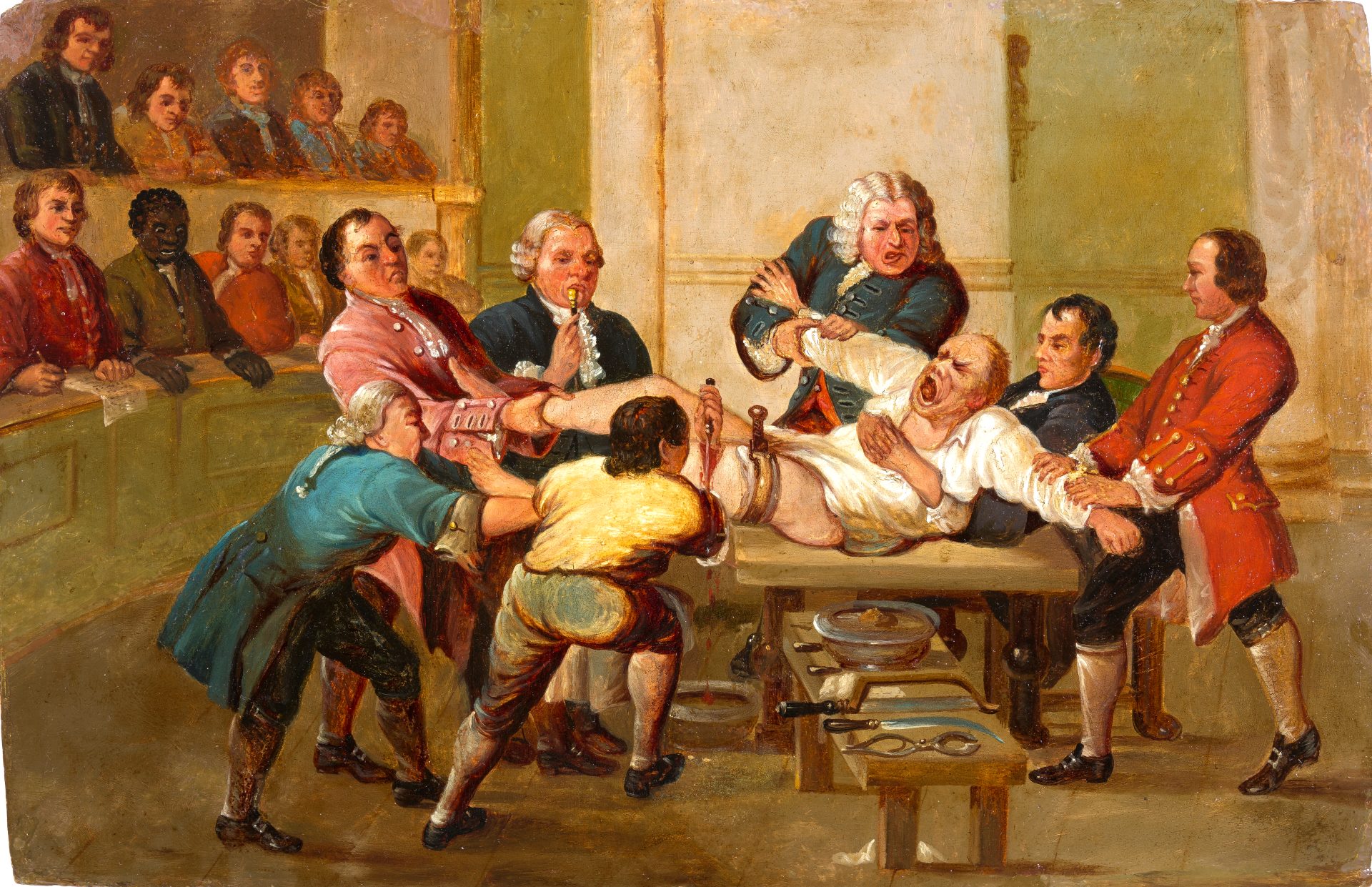 A painting depicting a man being held down on a table by a group of men. He is having his leg amputated. A group of men watches from the background.
